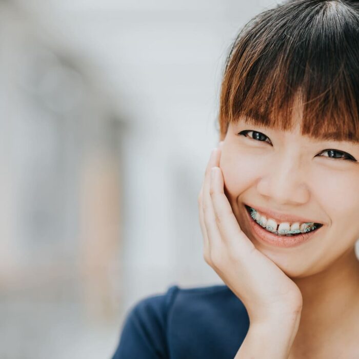 Top Braces in Glendale, CA