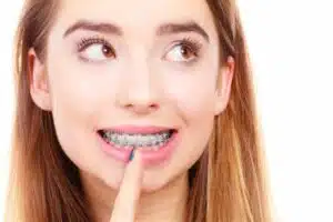Smiling young woman with braces, illustrating orthodontic treatment options and costs associated with braces.