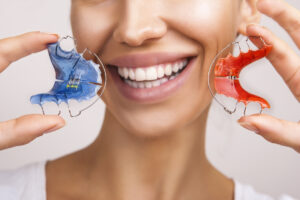How to Get a New Retainer