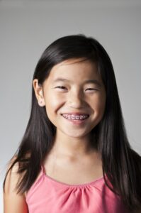 Early Orthodontic Treatment Los Angeles for Kids