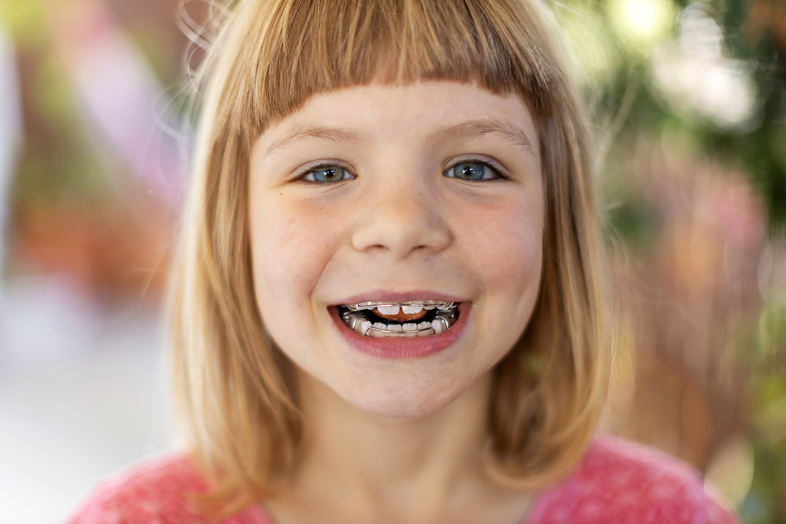Why Age 7 Orthodontist Visit Is Important