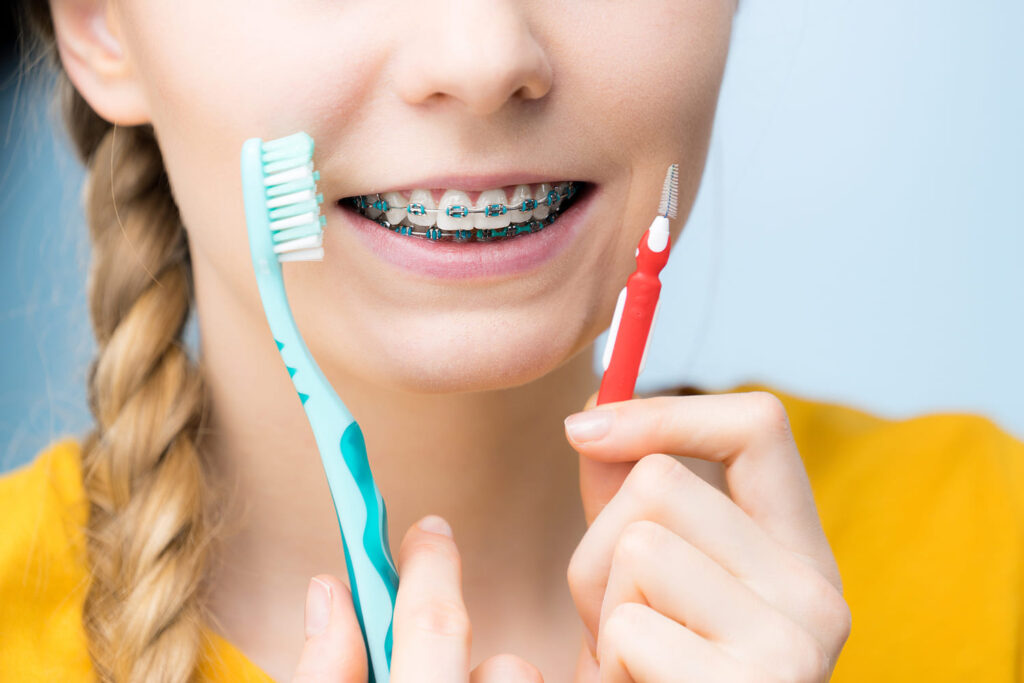 Brushing with Braces in Highland Park – Proper Oral Care Tips