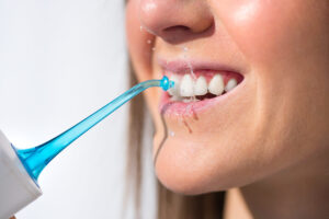 How to Brush Teeth with Braces – Daily Cleaning Routine