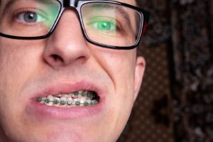 Braces Pain Relief Steps