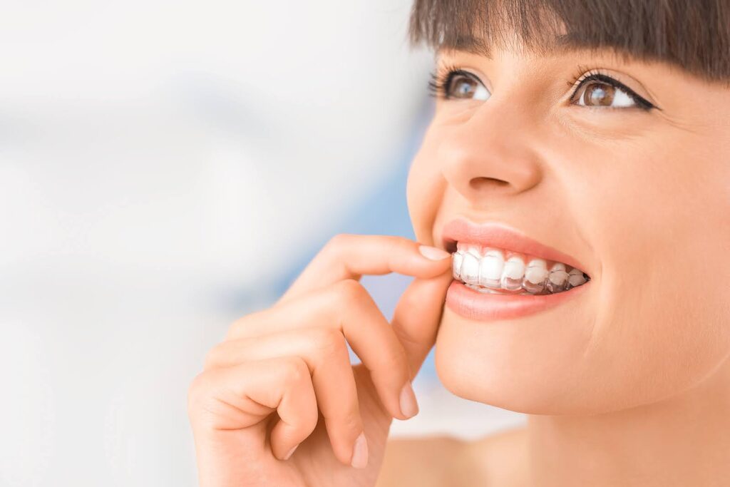 Clear Aligners for Busy Adults Invisalign in Glendale