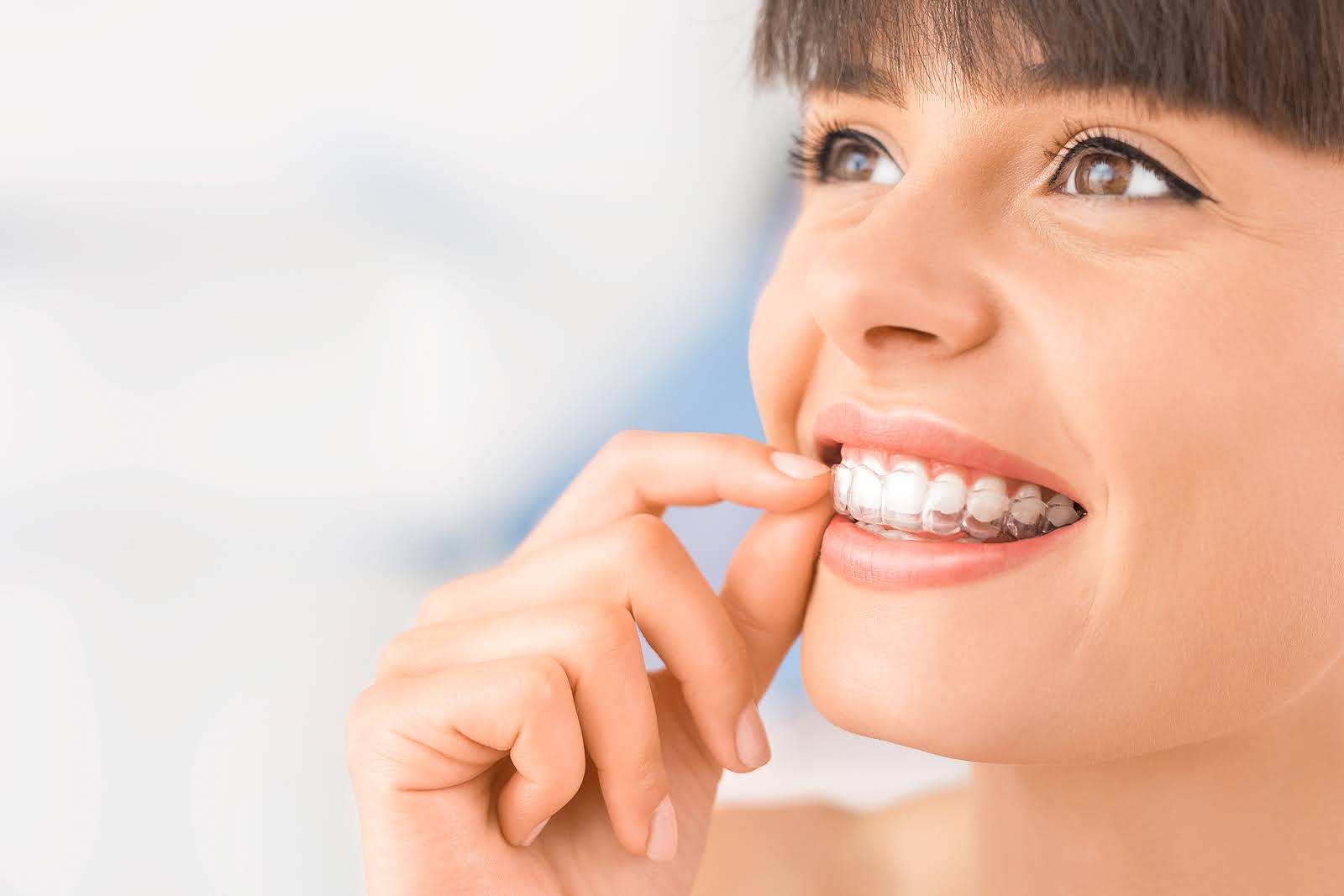 Clear Aligners for Busy Adults Invisalign in Glendale