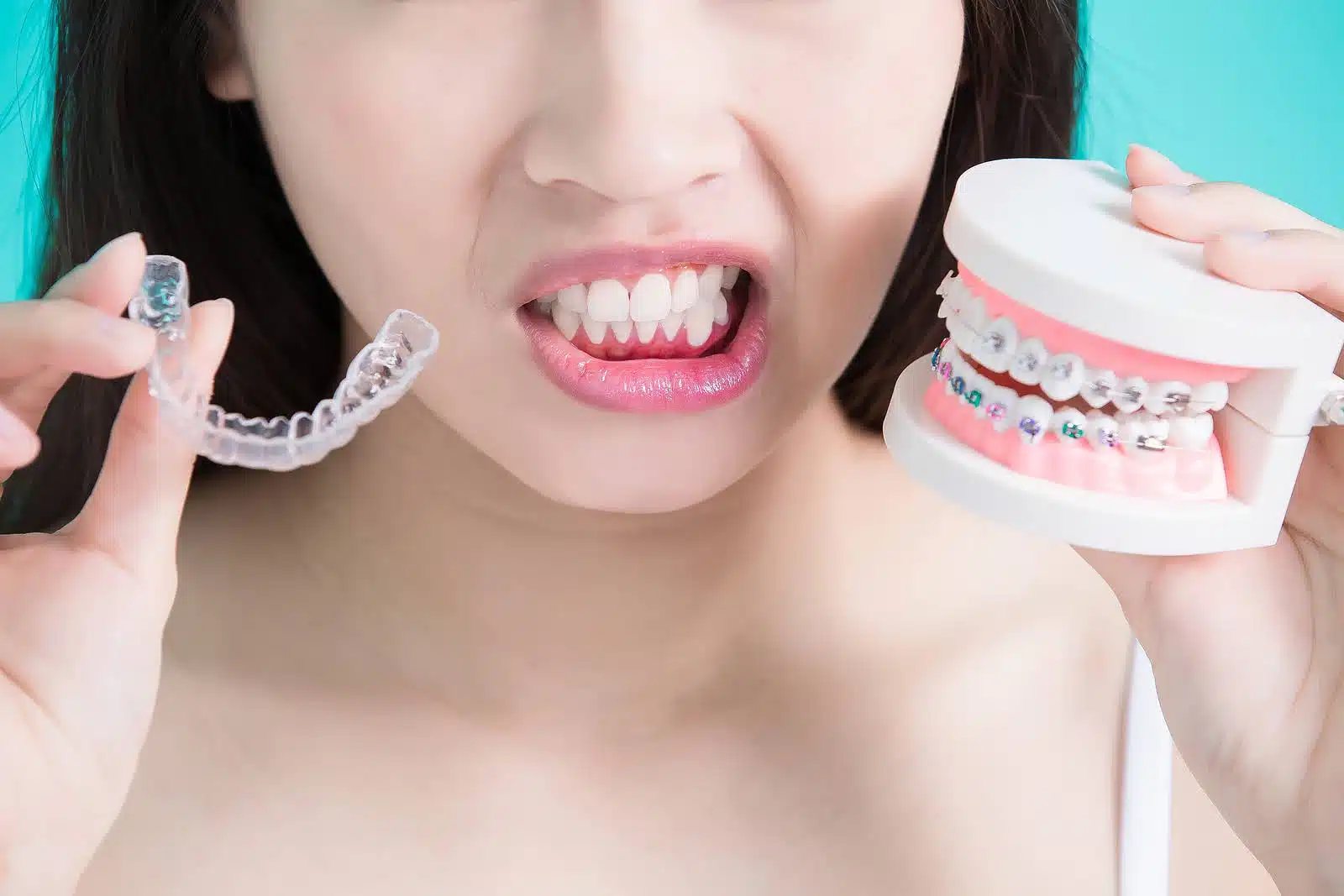 Woman holding clear aligner and model of traditional braces, illustrating options for orthodontic treatment.