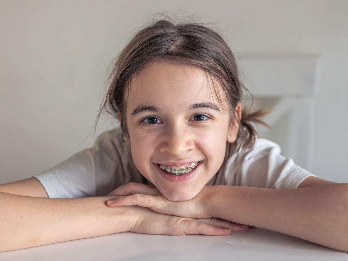 Smiling child showing braces as signs a child may need braces during growth