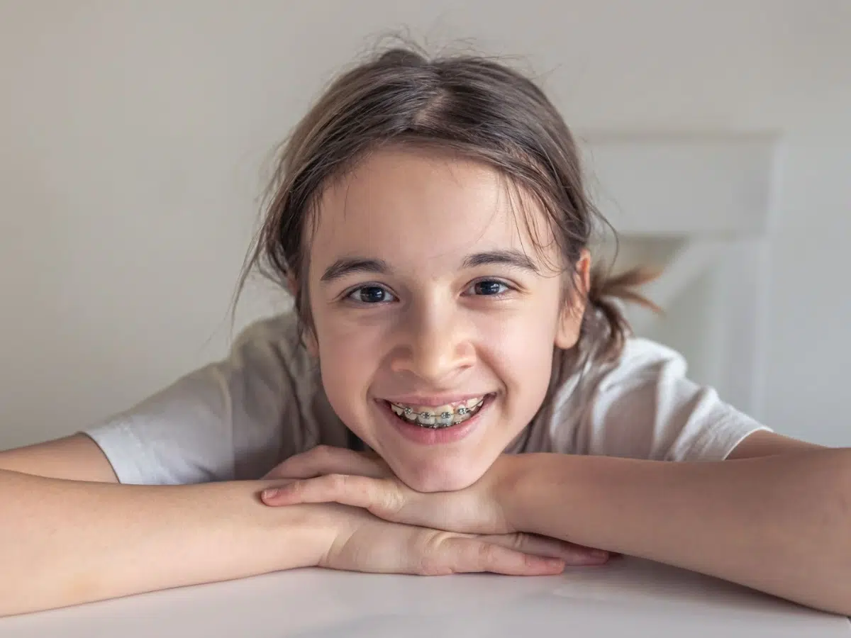 Smiling child with braces resting arms on a table, representing positive outcomes of early orthodontic treatment.