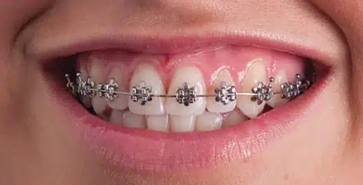 WildSmiles Flower Smile Close Up